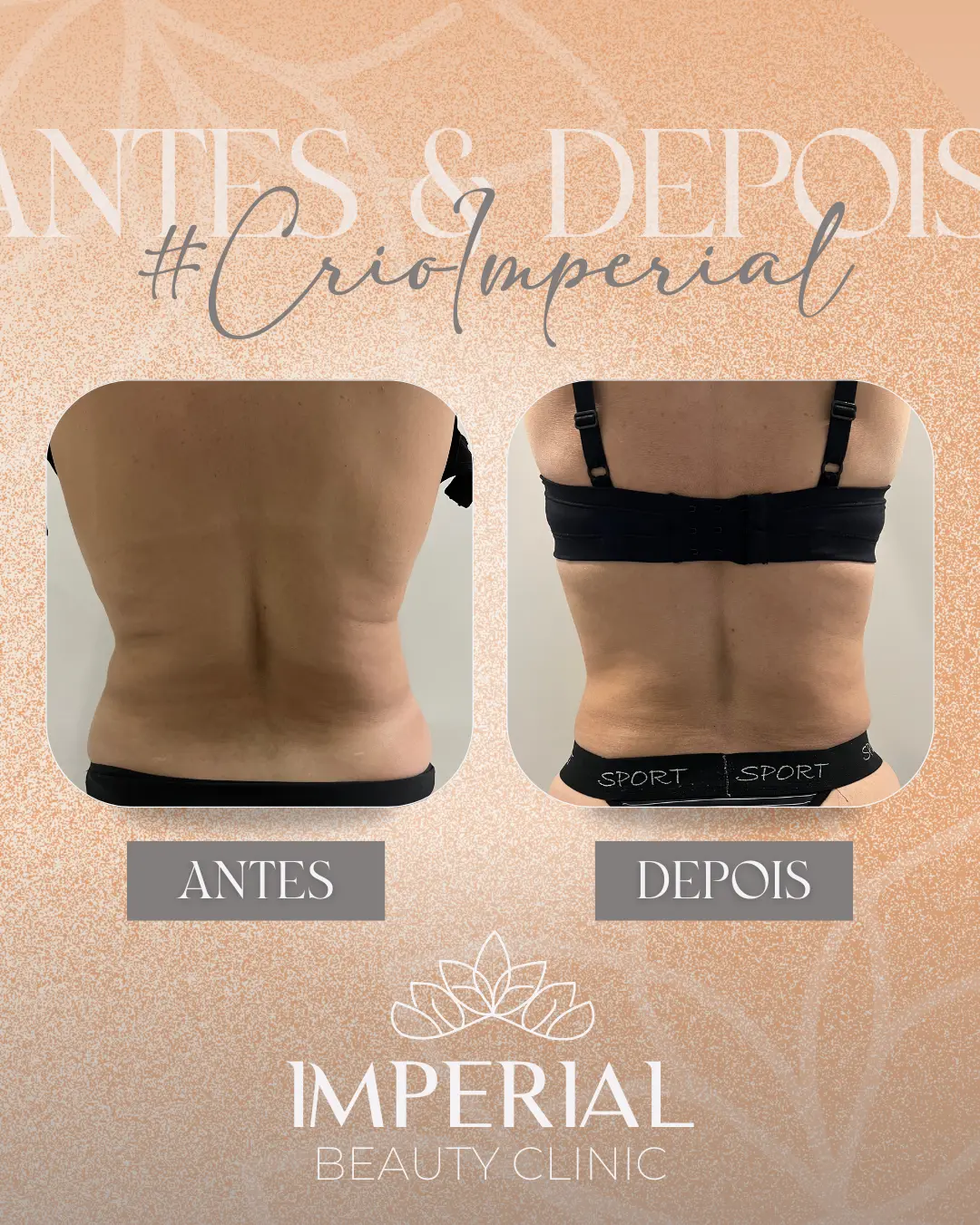 AnyConv.com__Layout costas