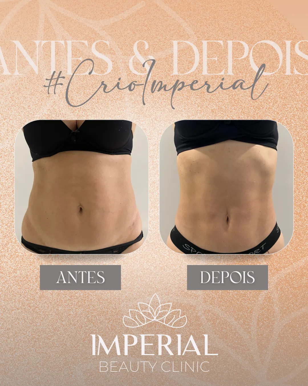 AnyConv.com__Layout frente