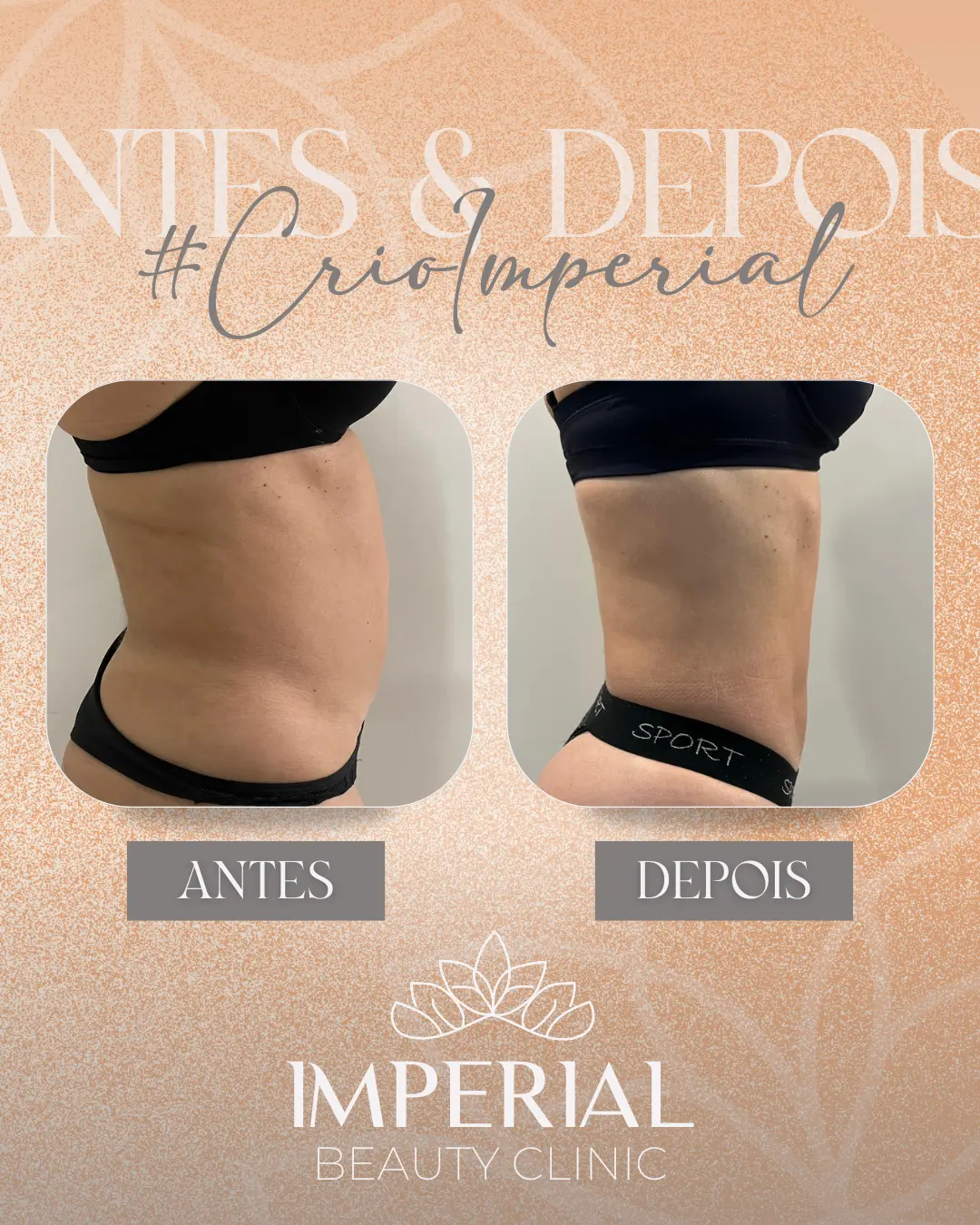 AnyConv.com__Layout lado