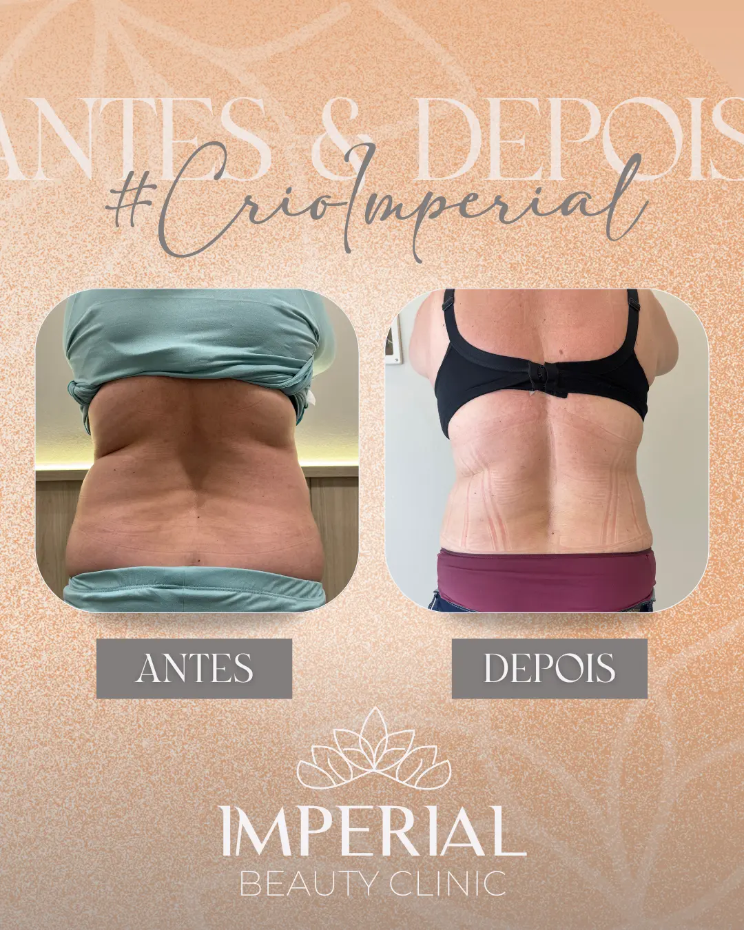 AnyConv.com__PRISCILA - layout costas