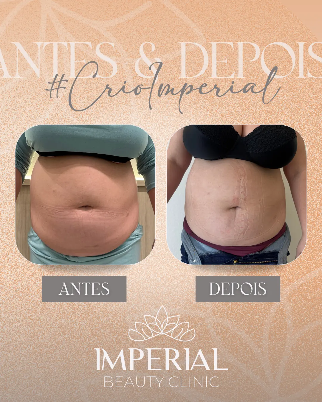 AnyConv.com__PRISCILA - layout frente